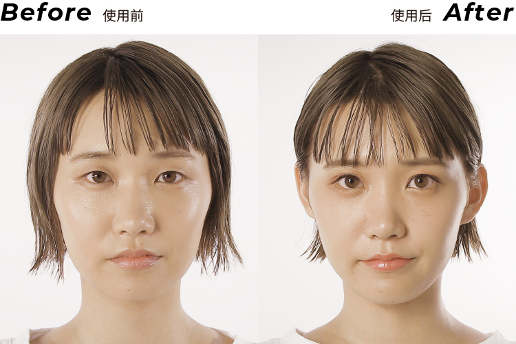 Before After