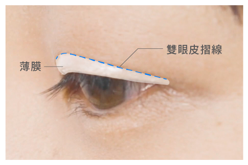 塗抹幹燥之後形成的輕薄硬膜嵌入眼皮打造雙眼皮