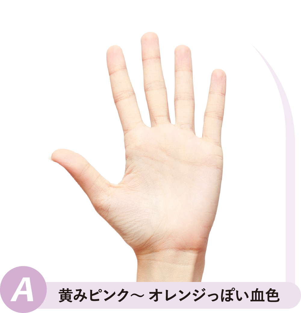 ⻩みピンク〜 オレンジっぽい⾎⾊